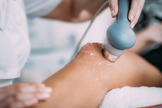 Ultrasound in Physical Therapy. Therapist Using Ultrasound Applicator on a Patient’s Knee